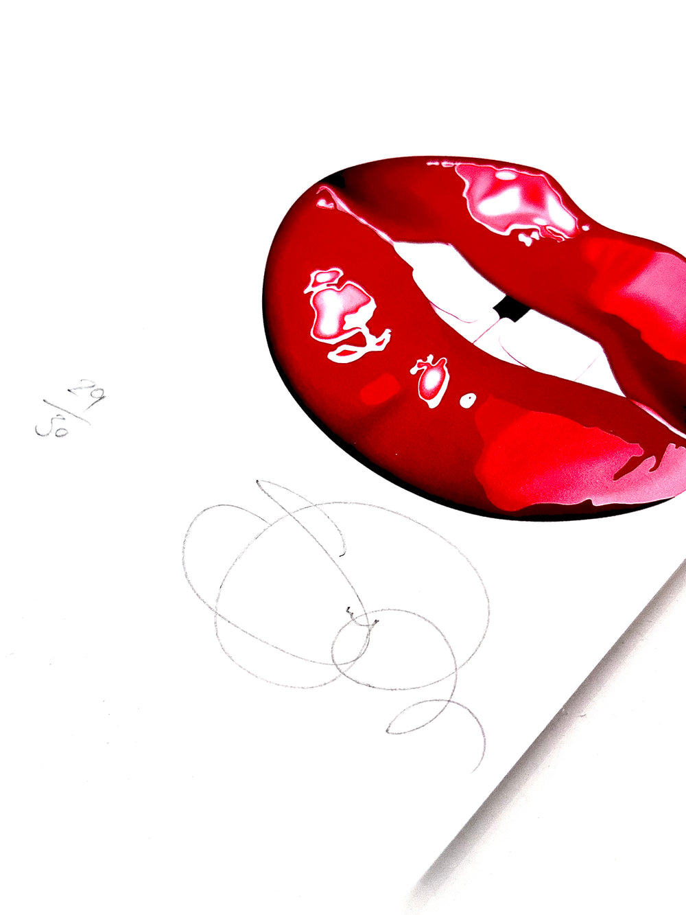 SCARLET FEVER